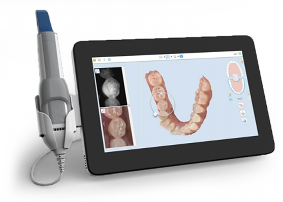 intraoral scanner